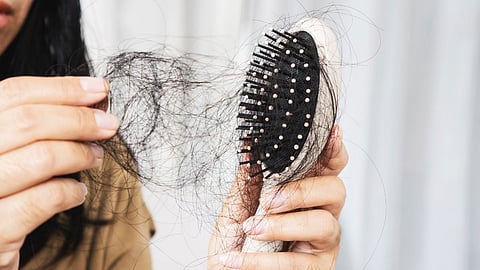 Hair Fall Causes