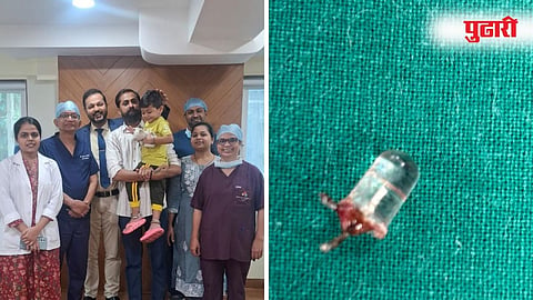 Rare Surgery Child Lung