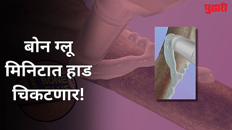 Bone Glue Invention 