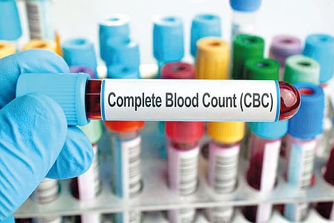 Blood Test Report  
