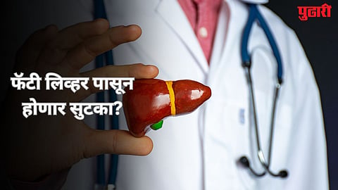 Fatty Liver Drug 