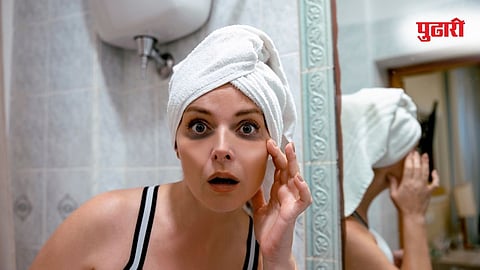 Dark Circles Home Remedies 