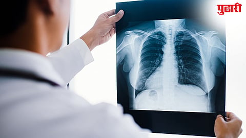 x-ray risk
