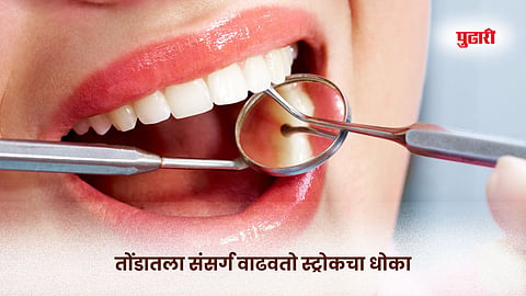 Oral health & stroke : तोंडातला संसर्ग वाढवतो स्ट्रोकचा धोका! नवीन संशोधनातून महत्त्वपूर्ण खुलासा