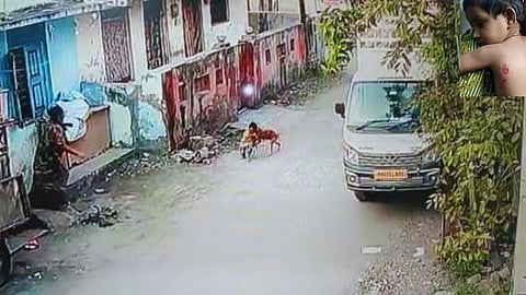 Dog attack