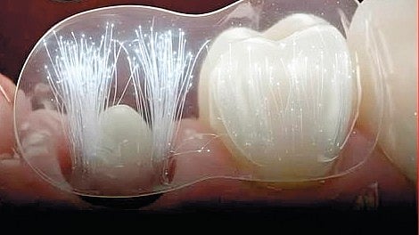 Natural Teeth Research