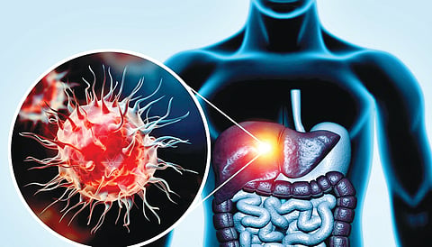 Cancer patient treatment