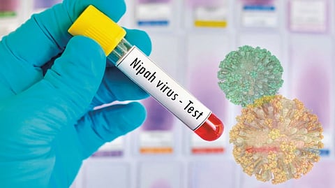 Nipah virus 