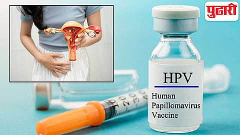 HPV vaccination Cervical Cancer symptoms prevention

