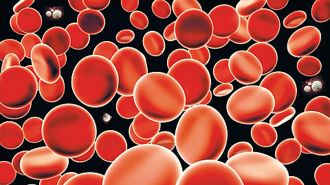 High Hemoglobin |