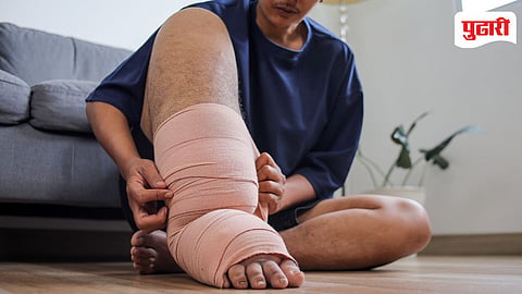 Elephantiasis 