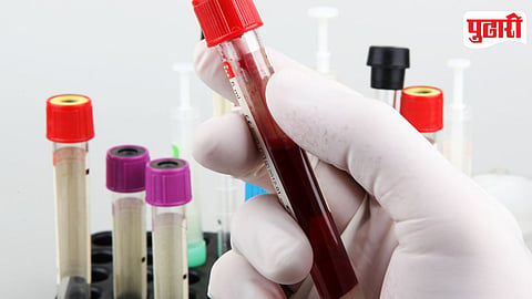 Blood Test