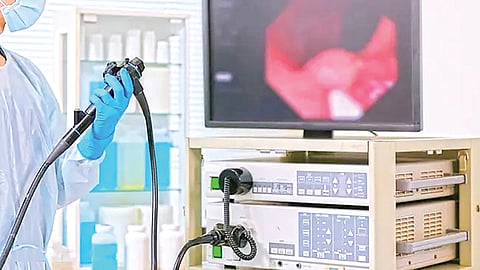 Colorectal Cancer