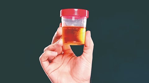 Blood in urine causes | 