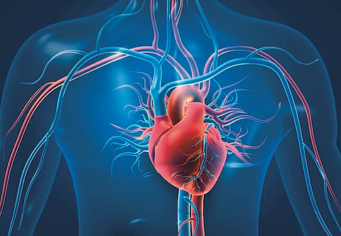 Heart Attack and Bypass Surgery |