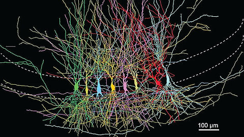 Brain structure study |