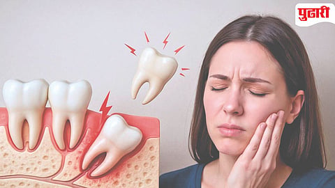 Wisdom Tooth
