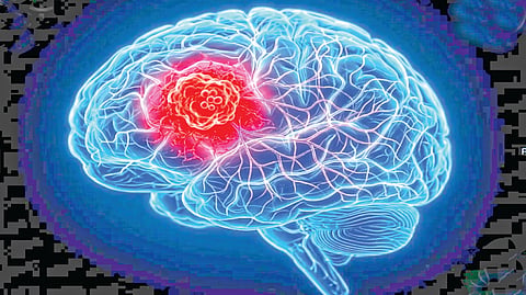 Threat of 'brain tumor' |