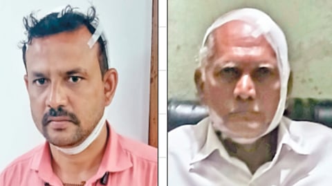 Tardal assault case | तारदाळला टोळक्याच्या मारहाणीत चौघे जखमी; सहा जणांवर गुन्हा 