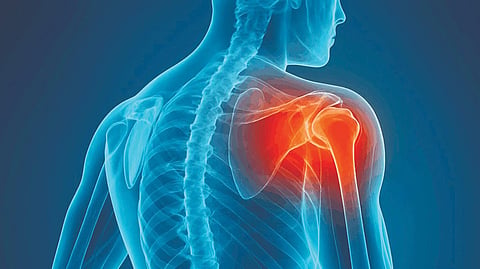 Shoulder Injury
