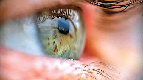 Eye Scan Blood Test |