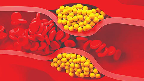 Gene Therapy | 