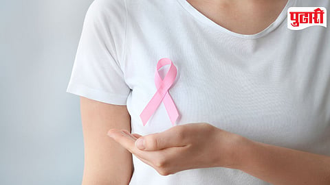 Breast Cancer