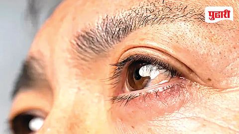 World Sight Donation Day Special
