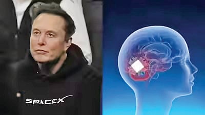 Brain Chip For Paralysis |