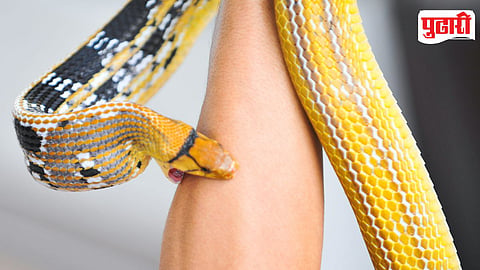 Snake Bite