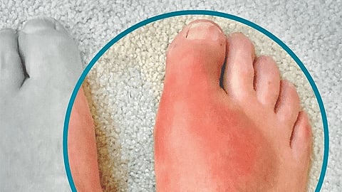 Diabetic foot care