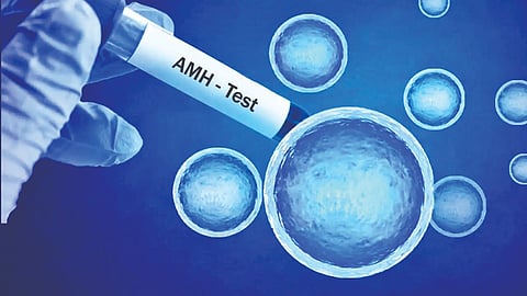 AMH Test | 