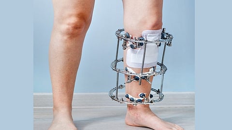 Knee Surgery |