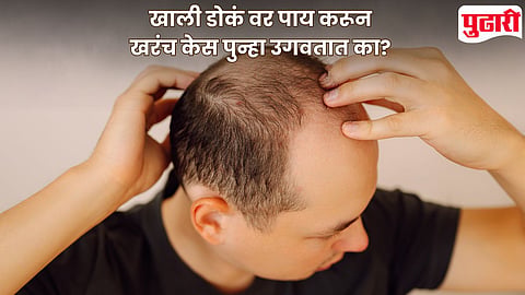 Hair Growth Inversion Method