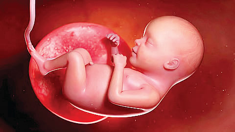Abortion case |