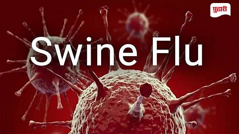 Swine Flu