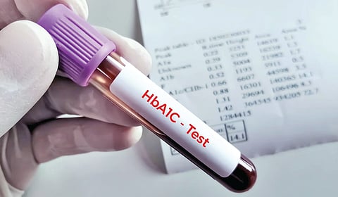 HbA1c Test |
