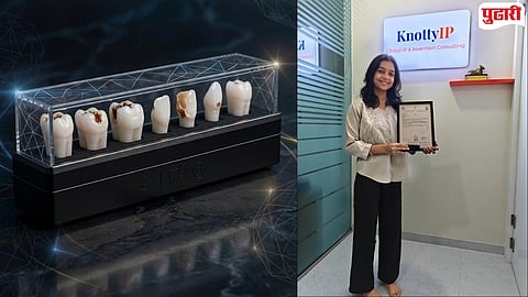 Shreya Hanchate Tooth Model