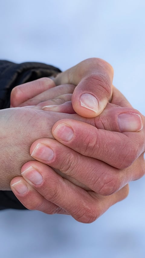 Cold Hands Feet Causes