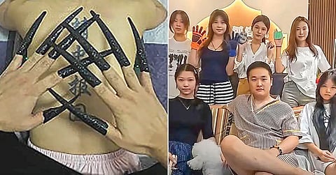 Body Scratching Service |