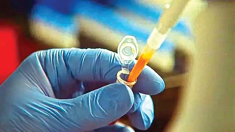 AI Enzyme System |