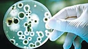 Leptospirosis epidemic