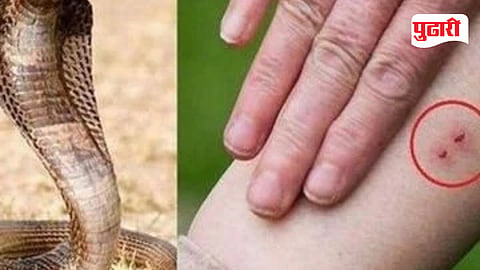 Vasai Virar Snakebite Cases