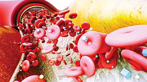 Blood Sugar Implant |
