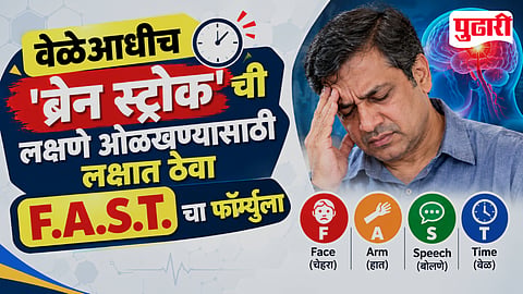 World Stroke Day