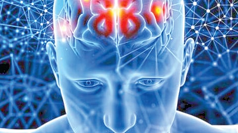 Brain Stroke Risk |