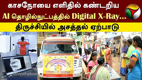 காசநோய் டிஜிட்டல் X-Ray.