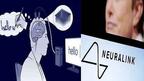 First human implanted with brain chip