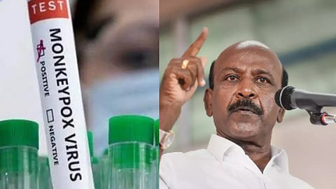 குரங்கம்மை