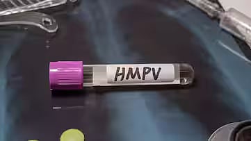 HMPV 